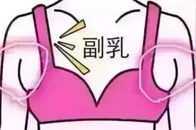 23岁胸部重度下垂，又没生过孩子，为什么会垂得这么早？图片