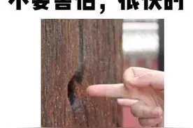 别眨眼，教你完成一次人类高质量肛门指检图片