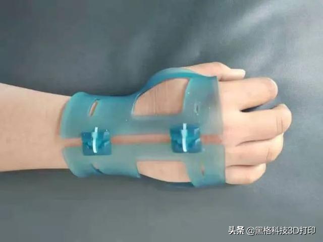 打了石膏痒怎么办