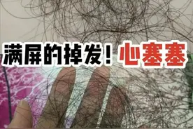 脱发严重差点秃头？这3个好物让你发量暴增！秃头星人赶紧收藏！图片