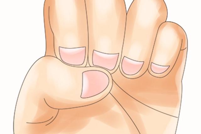 为什么指甲上有竖纹？指甲若出现4种异常，可能是癌或疾病的信号