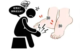 注意：老年人出现水肿，可能是心脏衰竭的信号，及早就医是关键图片