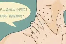 脖子和腋下的“小肉粒”是什么？可以用手拉吗？别忽视了图片