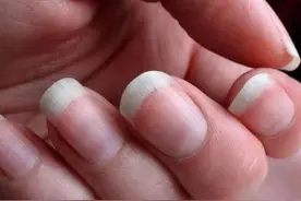 为什么有的人指甲上有月牙，有的人却没有？看完涨知识了图片