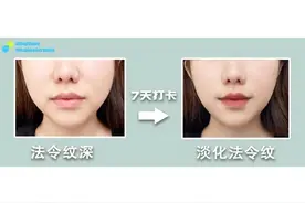 0成本｜不整容！一周淡化“法令纹”紧致脸部运动图片