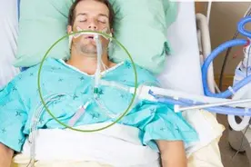 呼吸机的7种潜在并发症，和撤掉呼吸机的注意事项图片