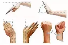 一例TFCC损伤的关节镜治疗图片