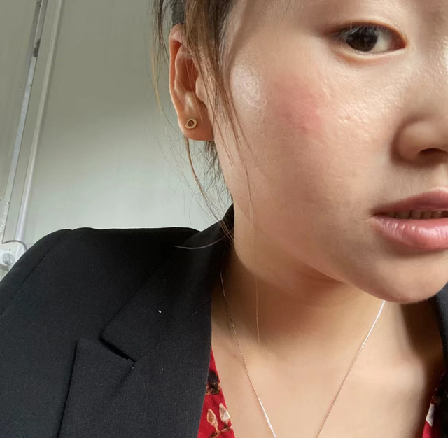 30、40岁的女人想要抗衰老，别着急用“视黄醇”，这样做更有效