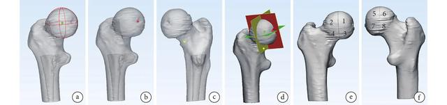 股骨头III期坏死能不能痊愈？需迈过这4道门槛，要不步入塌陷深渊