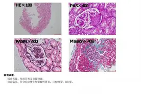 哈医大一院群力院区成功开展儿童全麻下肾脏穿刺活检术图片