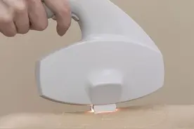 为什么这么多求美者会“爱上”冰点脱毛？图片