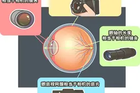 长治爱尔眼科医院：孩子散光怎么办？能不戴眼镜吗？图片