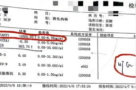 当心！甲胎蛋白大于2000，为什么不是原发性肝癌？图片