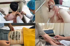 中医适宜技术—“中医日间病房” 开诊啦！！图片