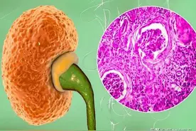 你知道父母双方是O+B型血，可以生出A型血的宝宝吗？图片