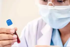 这10种血液检查很重要！竟然能查出这么多毛病？图片