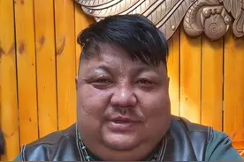 “羊亡爷”恩克不到半年吃110只羊，从不吃青菜，面色乌青疣扩散图片