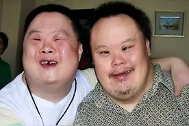 唐氏综合征患者，为什么长相都差不多？该如何预防这种疾病？图片