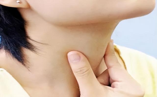 甲状腺结节二级会消除吗 2026年甲状腺结节二级会消除吗会癌变吗