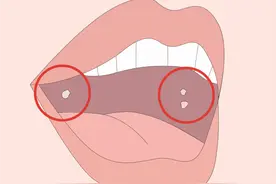 选C还是B？口腔溃疡该补充哪种维生素图片