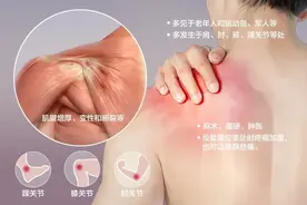 一文知道：什么是肌腱炎？图片