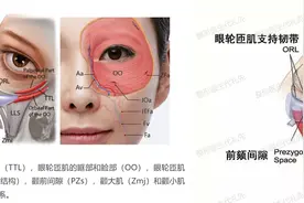 外切祛眼袋1-7天恢复图，看看55岁姐姐外切眼袋术后的恢复效果图图片