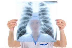你了解肋软骨炎？医生：它来临时，身体往往会有4大症状，需警惕图片