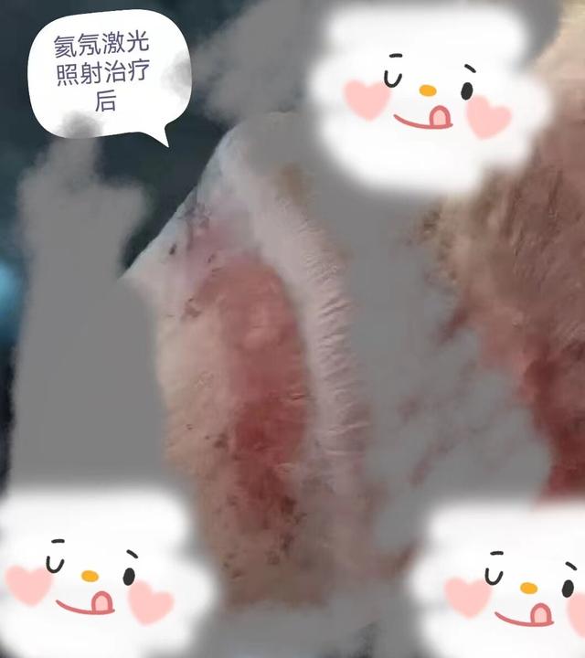 “丁头”发“炎”怎么办？—氦氖激光照射治疗为您排忧解“男”