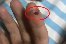 作为四害之一的臭虫有多可恨？为啥几乎绝迹的臭虫在广东泛滥了？图片