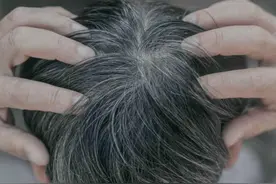 为啥白头发越长越多？你认为是老了，医生：或是缺乏3种营养素图片