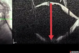 放弃5年，5天恢复，这是什么样的眼睛？图片