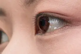 女生连戴10小时美瞳角膜险穿孔！我们该如何正确佩戴美瞳图片