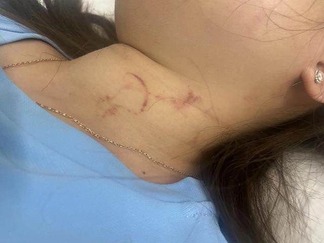 女子柬埔寨遭性侵报警要付小费