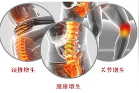 治骨质增生，李时珍只用两味药，这一方分享给大家，化全身骨刺图片