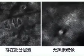 「被证实了」多吃黑色食物，多补黑色素，白癜风能自愈图片