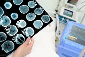 脑梗患者能饮酒吗？看看医学专家怎么说图片