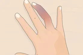 手指，手腕，脚趾，脚踝，万一骨折怎么办，多少天能恢复图片