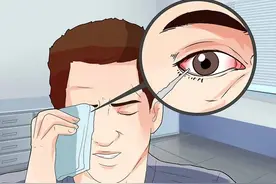 人体不承认眼球存在？一旦被发现，眼球很有可能被直接“灭杀”图片