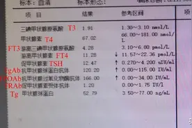 一文教你看懂甲状腺激素，判断甲状腺疾病图片
