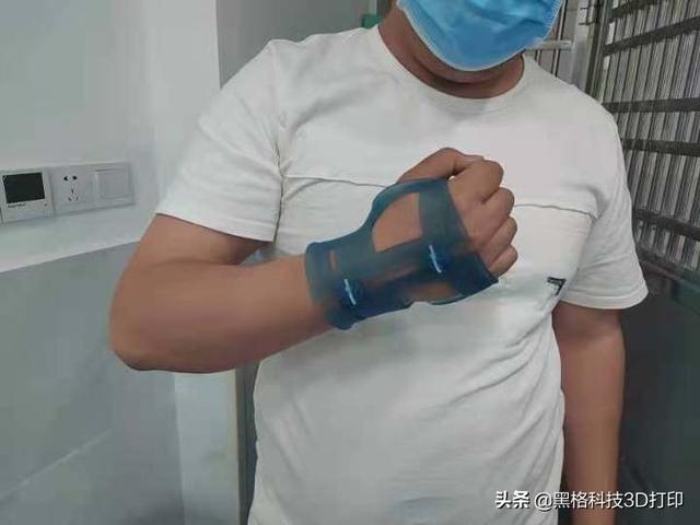 打了石膏痒怎么办