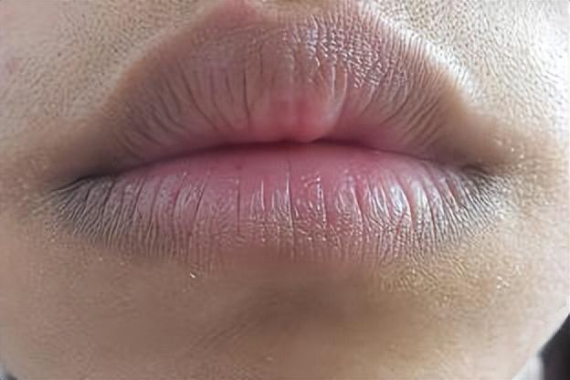 【嘴唇发黑】肝功能异常的12人群,是r1会出现嘴唇发黑症状的w1,尤其是