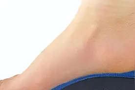 “脚底板”疼是怎么回事？不要再忽略这些问题，或许还挺严重呢图片