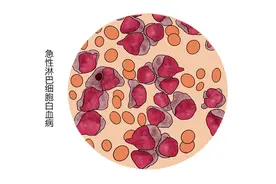 儿童白血病发病率持续上升，藏在身边的危险因素，家长需留意图片