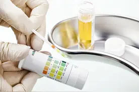 尿蛋白1+、2+、3+ ，它们分别代表什么含义及应对策略图片