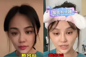 千万网红“樊小慧”整容引热议，撕开了单亲妈妈最脆弱的一面图片