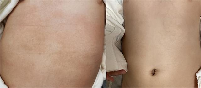 瀹濆疂婀跨柟鍙嶅鍙戜綔锛屽姝ょ儲浜猴紝瀹濆浠埌搴曡鎬庝箞鍋氾紵