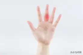 骨科大夫详细告诉你：什么是腱鞘炎图片