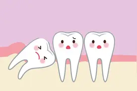 拔智齿不拍片可以直接拔吗？图片