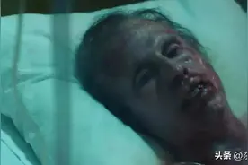 来自地狱的恶魔，核辐射有多恐怖，现代医学在核辐射面前等同虚设图片