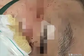 江西理工外籍学生打人后续！警方已介入，原因曝光，受害者已毁容图片